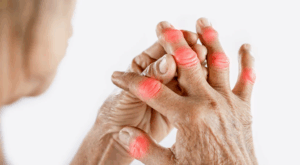Ultimate Relief: Joint Pain Solutions